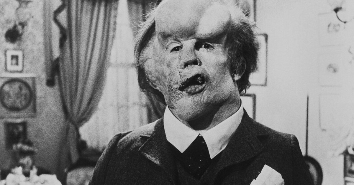 Sloní muž se dočká hned několika nových zpracování